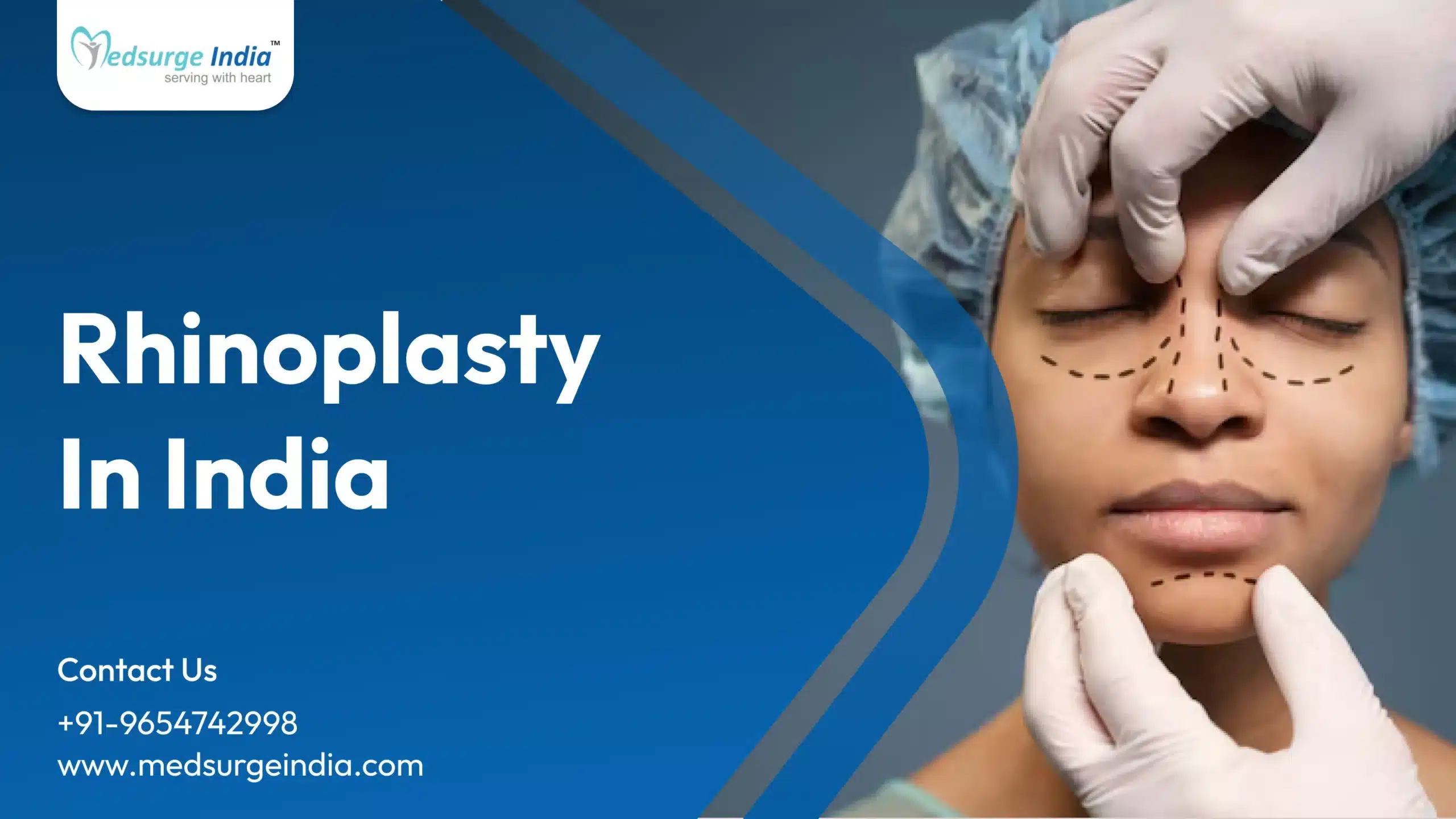 Rhinoplasty Cost in India